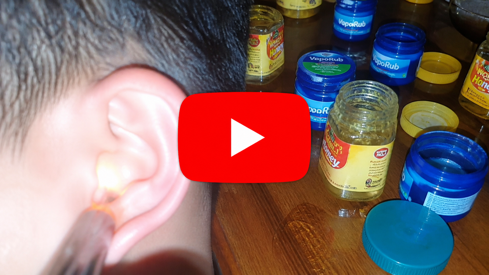 Watch The Tinnitus Presentation